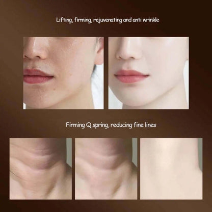 Microcurrent Face Lifting Device